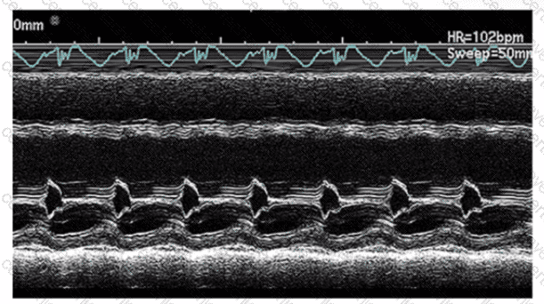 AE-Adult-Echocardiography Q9