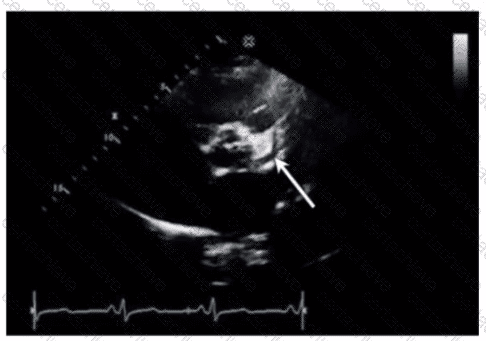 AE-Adult-Echocardiography Q8