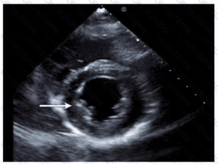 AE-Adult-Echocardiography Q10