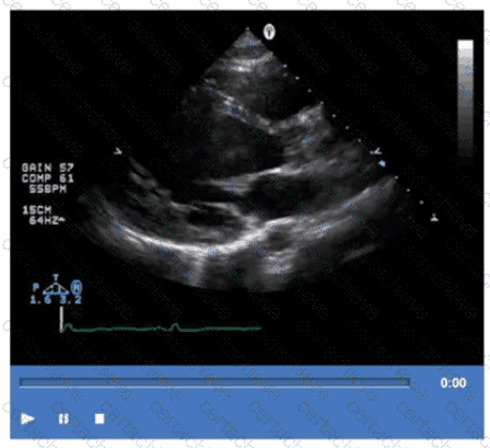 AE-Adult-Echocardiography Q5
